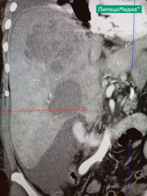 � �������� �������� �� ����� ���������� ��������